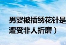 男婴被插绣花针是什么情况（50天男婴莫名遭受非人折磨）