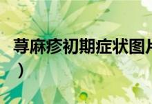 荨麻疹初期症状图片（荨麻疹消退最快的方法）