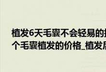 植发6天毛囊不会轻易的掉吧（植发可以维持多久呢_5000个毛囊植发的价格_植发后三年内掉光了）