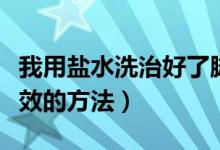 我用盐水洗治好了脚气（脚气怎么根治简单有效的方法）