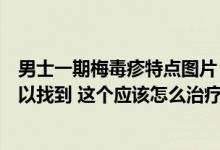 男士一期梅毒疹特点图片（男性一期梅毒症状图片在哪里可以找到 这个应该怎么治疗呢）